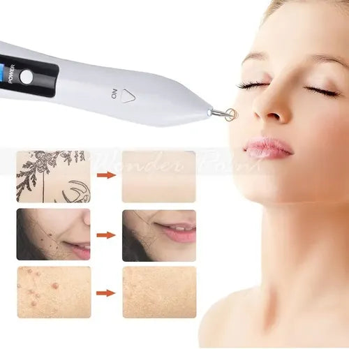 PLASMA PEN PRO - ELIMINADOR DE MANCHAS Y LUNARES